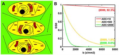 A Modified Tri-Exponential Model for Multi-b-value Diffusion-Weighted Imaging: A Method to Detect the Strictly Diffusion-Limited Compartment in Brain